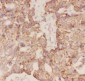 Anti-FSH Beta Picoband Antibody